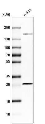 Western Blot: PGRMC2 Antibody [NBP2-13753]