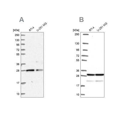 Western Blot: PGRMC2 Antibody [NBP2-13753]