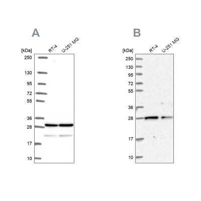 Western Blot: PGRMC2 Antibody [NBP2-49289]