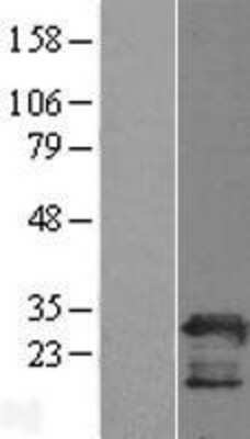 Western Blot: PGRMC2 Overexpression Lysate [NBL1-14342]