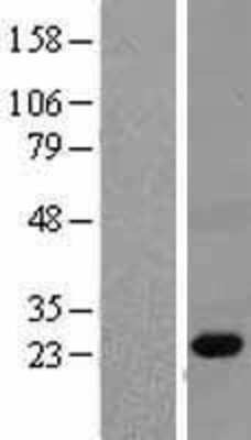 Western Blot: PGLYRP1/PGRP-S Overexpression Lysate [NBL1-14334]