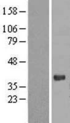 Western Blot: PGLYRP3/PGRPIA Overexpression Lysate [NBL1-14336]