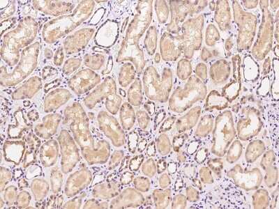 Immunohistochemistry-Paraffin: PGS1 Antibody [NBP2-97697]