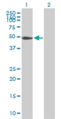 Western Blot: PGS1 Antibody [H00009489-B01P]