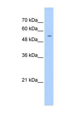 Western Blot: PGS1 Antibody [NBP1-52834]