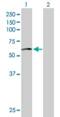 Western Blot: PHACS Antibody [H00084680-B01P]