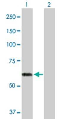 Western Blot: PHACS Antibody [H00084680-D01P]