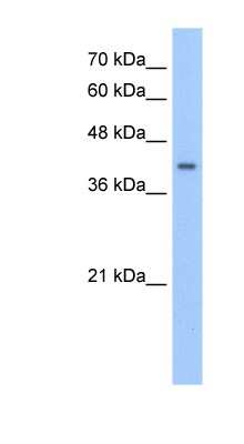 Western Blot: PHACS Antibody [NBP1-52839]