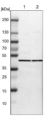 Western Blot: PHACS Antibody [NBP1-90260]