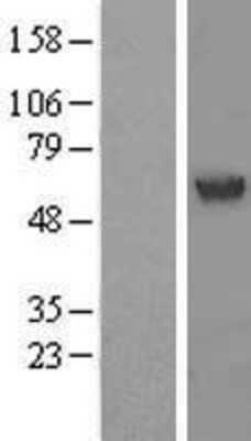 Western Blot: PHACS Overexpression Lysate [NBL1-07234]