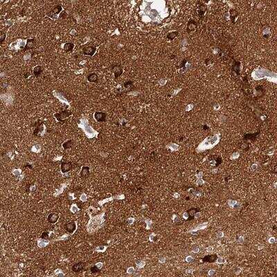 Immunohistochemistry-Paraffin: PHACTR1 Antibody [NBP1-85185]