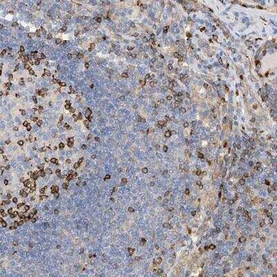 Immunohistochemistry-Paraffin: PHACTR2 Antibody [NBP1-86742]