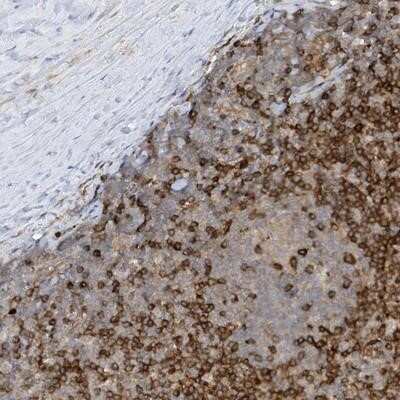 Immunohistochemistry-Paraffin: PHACTR2 Antibody [NBP1-86744]