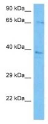 Western Blot: PHACTR2 Antibody [NBP3-10079]