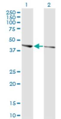 Western Blot: PHACTR3 Antibody (4A5) [H00116154-M02]