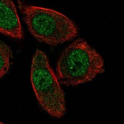 Immunocytochemistry/ Immunofluorescence: PHACTR3 Antibody [NBP2-55045]