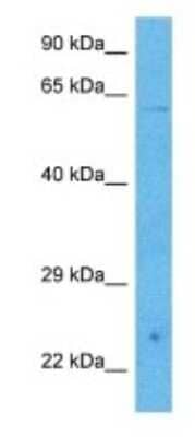 Western Blot: PHACTR3 Antibody [NBP3-09933]