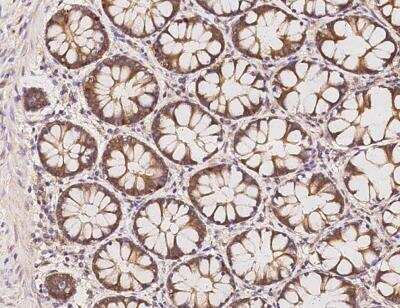 Immunohistochemistry-Paraffin: PHACTR4 Antibody [NBP3-05782]