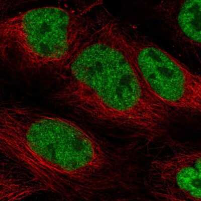 Immunocytochemistry/ Immunofluorescence: PHAX Antibody [NBP2-48821]