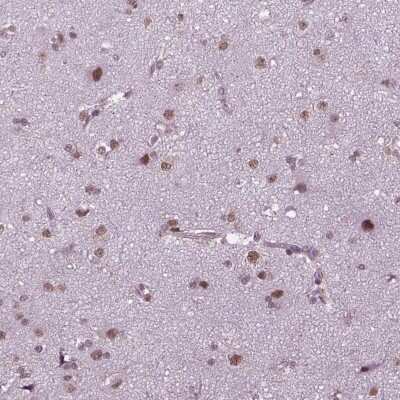 Immunohistochemistry: PHAX Antibody [NBP2-48821]