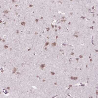 Immunohistochemistry-Paraffin: PHAX Antibody [NBP2-48821]