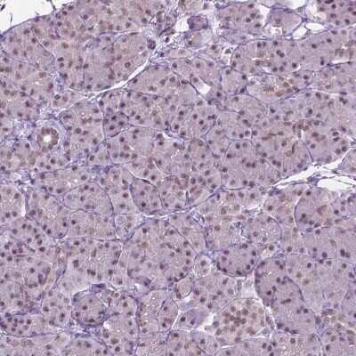 Immunohistochemistry-Paraffin: PHAX Antibody [NBP2-48821]