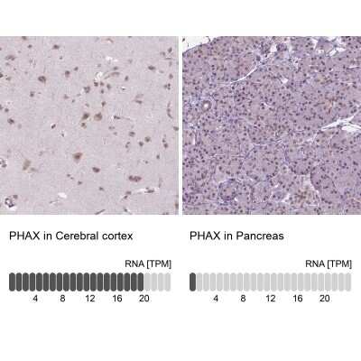 Immunohistochemistry-Paraffin: PHAX Antibody [NBP2-48821]