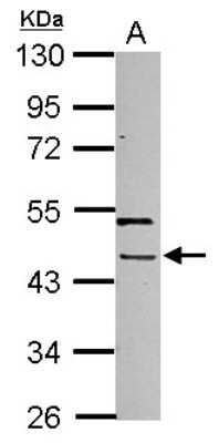 Western Blot: PHAX Antibody [NBP2-19792]