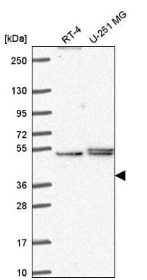 Western Blot: PHAX Antibody [NBP2-55912]