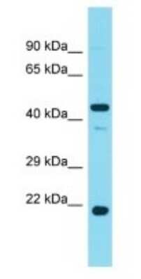 Western Blot: PHAX Antibody [NBP3-09461]