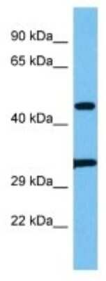 Western Blot: PHAX Antibody [NBP3-10101]