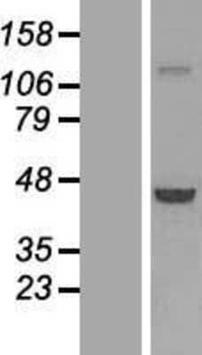 Western Blot: PHAX Overexpression Lysate [NBL1-15472]