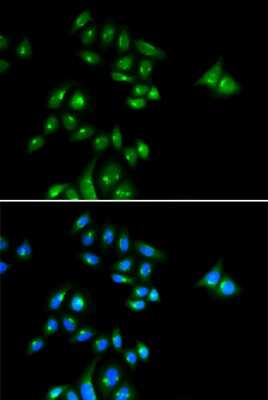 Immunocytochemistry/ Immunofluorescence: PHC3 Antibody - BSA Free [NBP3-04368]