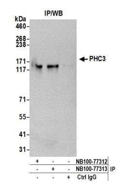 Immunoprecipitation: PHC3 Antibody [NB100-77312]