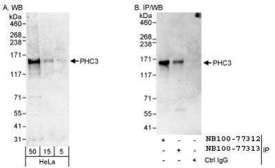 Western Blot: PHC3 Antibody [NB100-77312]
