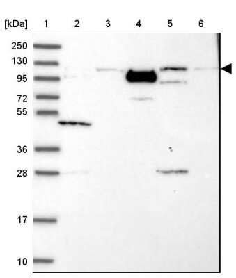 Western Blot: PHC3 Antibody [NBP1-84896]