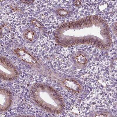 Immunohistochemistry-Paraffin: PHCA Antibody [NBP2-68894]