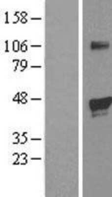 Western Blot: EGLN2/PHD1 Overexpression Lysate [NBL1-10154]