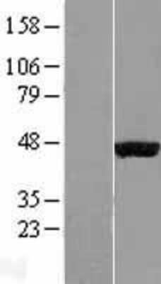 Western Blot: EGLN2/PHD1 Overexpression Lysate [NBL1-10155]