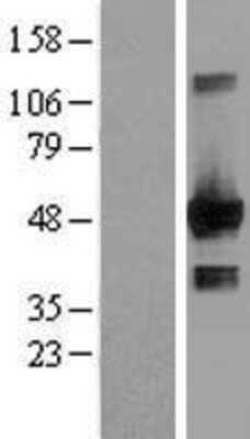 Western Blot: EGLN1/PHD2 Overexpression Lysate [NBL1-10153]