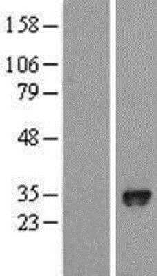 Western Blot: EGLN3/PHD3 Overexpression Lysate [NBL1-10156]