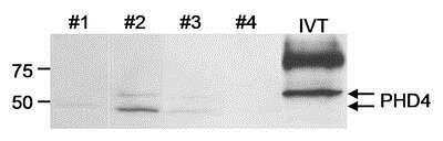 Western Blot: PHD4/HIF Prolyl Hydroxylase 4 Antibody [NB100-295]