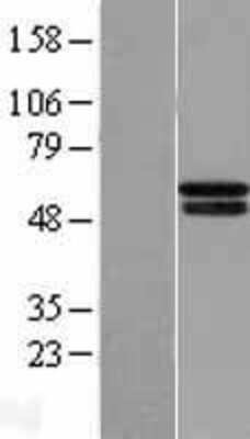 Western Blot: PHD4/HIF Prolyl Hydroxylase 4 Overexpression Lysate [NBL1-14344]