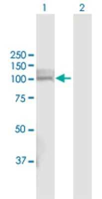 Western Blot: PHEX Antibody [H00005251-D01P]