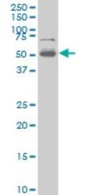 Western Blot: PHF1 Antibody (2A12) [H00005252-M03]