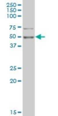 Western Blot: PHF1 Antibody (4D8) [H00005252-M02]