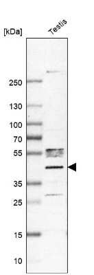 Western Blot: PHF1 Antibody [NBP1-82613]