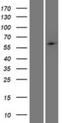 Western Blot: PHF1 Overexpression Lysate [NBP2-06342]