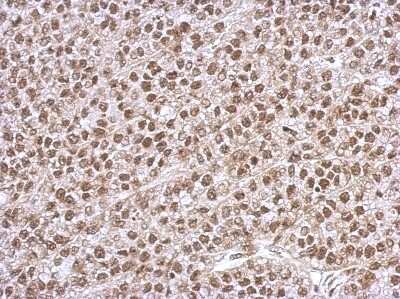 Immunohistochemistry-Paraffin: PHF10 Antibody [NBP2-19795]