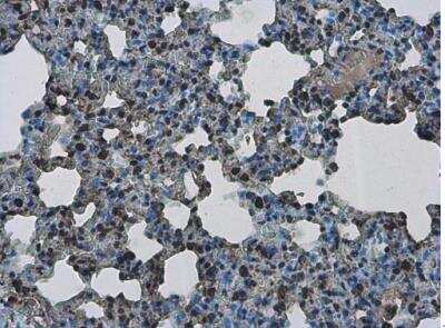 Immunohistochemistry-Paraffin: PHF10 Antibody [NBP2-19795]